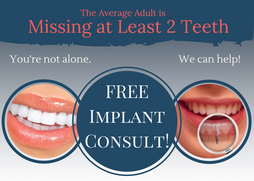 Implants Patient Offer